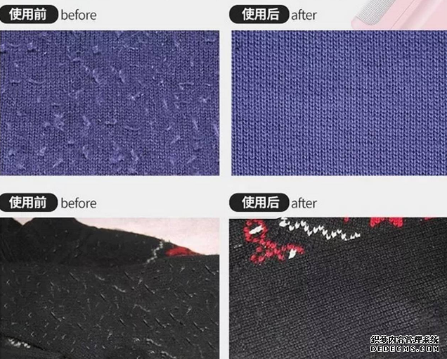 What should I do if my sweater pills? How should I maintain my sweater What should I do if my sweater pills? How should I maintain my sweater